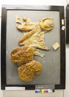 Collezione di Anatomia Patologica e Teratologia Veterinaria